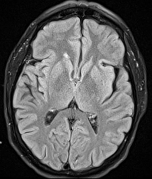 MRI IMAGE