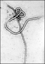 ebolavirus